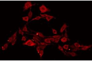 ABIN6269106 staining NIH-3T3 by IF/ICC. (EIF4E Antikörper  (C-Term))