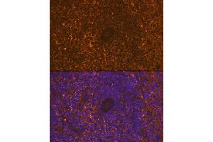 Immunofluorescence (IF) image for anti-Tumor Necrosis Factor Receptor Superfamily, Member 8 (TNFRSF8) antibody (ABIN7271072)