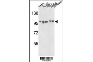 Western blot analysis of ACTN4 Antibody in T47D, A2058, A375, HepG2 cell line and mouse bladder tissue lysates (35ug/lane) (alpha Actinin 4 Antikörper  (C-Term))