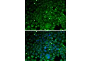 Immunofluorescence analysis of HeLa cells using CRYAA antibody. (CRYAA Antikörper  (AA 1-173))