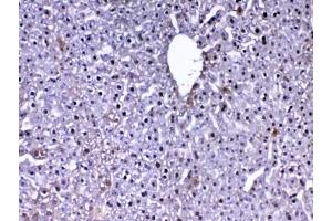 IHC testing of FFPE mouse liver tissue with DJ-1 antibody at 1ug/ml. (PARK7/DJ1 Antikörper)