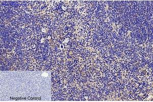 Immunohistochemical analysis of paraffin-embedded mouse liver tissue. (CD68 Antikörper)