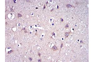 Immunohistochemical analysis of paraffin-embedded brain tissues using MMP9 mouse mAb with DAB staining.