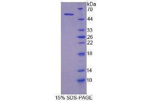 SDS-PAGE analysis of Human MYLK Protein. (MYLK Protein)