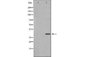 Western blot analysis of Hela whole cell lysates, using PSMF1 Antibody. (PSMF1 Antikörper  (C-Term))