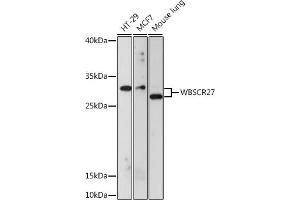 Western blot analysis of extracts of various cell lines, using WBSCR27 antibody (ABIN7271366) at 1:1000 dilution. (WBSCR27 Antikörper  (AA 1-245))