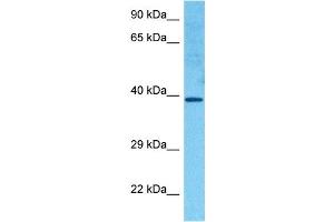 Host:  Rabbit  Target Name:  HOXC11  Sample Tissue:  Human RPMI 8226 Whole Cell  Antibody Dilution:  1ug/ml (HOXC11 Antikörper  (Middle Region))