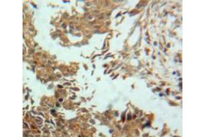 Used in DAB staining on fromalin fixed paraffin-embedded ovary tissue (ENPP2 Antikörper  (AA 637-905))