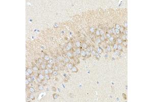 Immunohistochemistry (IHC) image for anti-Beta-secretase 1 (BACE1) (AA 22-322) antibody (ABIN6137413)