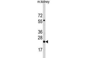 Western Blotting (WB) image for anti-Phosphatidylethanolamine N-Methyltransferase (PEMT) antibody (ABIN5015225) (PEMT Antikörper)