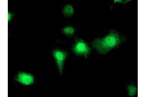Anti-EIF2B3 mouse monoclonal antibody (ABIN2455016) immunofluorescent staining of COS7 cells transiently transfected by pCMV6-ENTRY EIF2B3 (RC223570). (EIF2B3 Antikörper)
