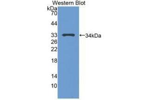 Detection of Recombinant TP53, Human using Polyclonal Antibody to Tumor Protein p53 (P53) (p53 Antikörper  (AA 108-370))