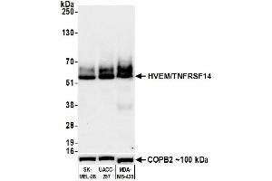 Western Blotting (WB) image for anti-Tumor Necrosis Factor Receptor Superfamily, Member 14 (TNFRSF14) (AA 39-200) antibody (ABIN7449437)