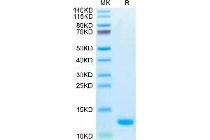Biotinylated Human CCL5 on Tris-Bis PAGE under reduced condition. (CCL5 Protein (AA 24-91) (His-Avi Tag,Biotin))