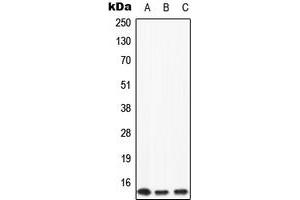 Western blot analysis of Apolipoprotein C2 expression in HeLa (A), mouse liver (B), rat liver (C) whole cell lysates.
