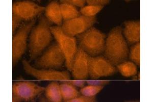 Immunofluorescence analysis of HeLa cells using ZC3H7A Polyclonal Antibody at dilution of 1:100. (ZC3H7A Antikörper)