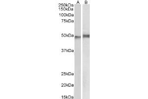ABIN184583 (1µg/ml) staining of Mouse Thymus (A) and Pig Spleen (B) lysate (35µg protein in RIPA buffer). (NCF1 Antikörper  (C-Term))