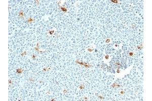 Formalin-fixed, paraffin-embedded human Tonsil stained with Macrophage Monoclonal Antibody (LN-5) (Macrophage / Histiocytoma Marker Antikörper)