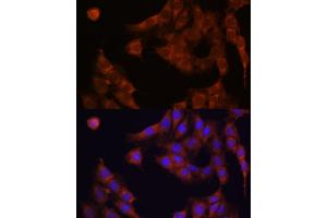 Immunofluorescence analysis of C6 cells using GANAB antibody  at dilution of 1:100. (GANAB Antikörper  (AA 1-260))