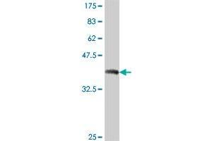 Western Blotting (WB) image for anti-DNA Fragmentation Factor, 40kDa, beta Polypeptide (Caspase-Activated DNase) (DFFB) (AA 229-338) antibody (ABIN560596)