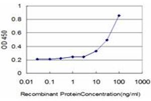 Detection limit for recombinant GST tagged DLD is approximately 1ng/ml as a capture antibody. (DLD Antikörper  (AA 1-509))