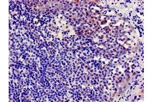 Immunocytochemistry analysis of human tonsil tissue using ABIN7145942 at dilution of 1:100 (CCR7 Antikörper  (AA 332-378))
