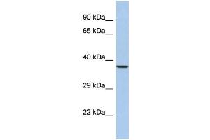 Western Blotting (WB) image for anti-Synaptotagmin IX (SYT9) (N-Term) antibody (ABIN2785341) (SYT9 Antikörper  (N-Term))