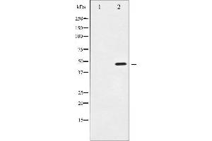 Western blot analysis of IKK-gamma expression in 293 whole cell lysates,The lane on the left is treated with the antigen-specific peptide. (IKBKG Antikörper  (N-Term))