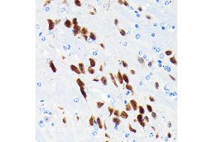 Immunohistochemistry of paraffin-embedded mouse brain using NeuN Rabbit mAb (ABIN7270098) at dilution of 1:100 (40x lens). (NeuN Antikörper)