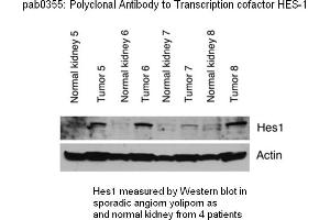 Image no. 1 for anti-Hes Family bHLH Transcription Factor 1 (HES1) (C-Term) antibody (ABIN347373) (HES1 Antikörper  (C-Term))