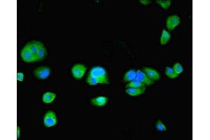 Immunofluorescent analysis of MCF-7 cells using ABIN7173722 at dilution of 1:100 and Alexa Fluor 488-congugated AffiniPure Goat Anti-Rabbit IgG(H+L) (TPPP2 Antikörper  (AA 1-170))