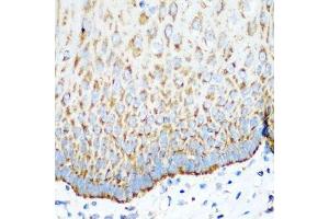 Immunohistochemistry of paraffin-embedded human esophagus using MT-CO2 antibody.