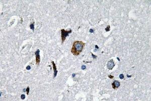 Immunohistochemistry (IHC) analyzes of ACE1 antibody in paraffin-embedded human brain tissue. (Angiotensin I Converting Enzyme 1 Antikörper)