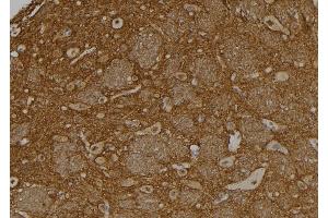 ABIN6273411 at 1/100 staining Rat brain tissue by IHC-P. (USP37 Antikörper  (Internal Region))