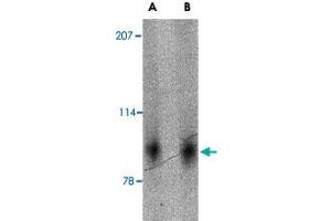 Western blot analysis of SLITRK2 in mouse brain tissue lysate with SLITRK2 polyclonal antibody  at (A) 1 and (B) 2 ug/mL . (SLITRK2 Antikörper  (Internal Region))