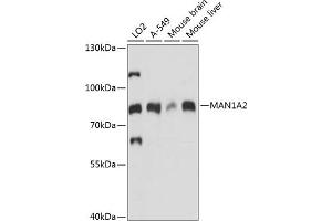 Western blot analysis of extracts of various cell lines, using M antibody (ABIN7268390) at 1:1000 dilution. (MAN1A2 Antikörper  (AA 60-180))
