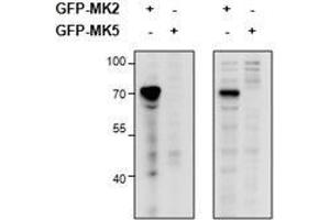 Western Blotting (WB) image for anti-Mitogen-Activated Protein Kinase-Activated Protein Kinase 2 (MAPKAPK2) antibody (ABIN5903087) (MAPKAP Kinase 2 Antikörper)