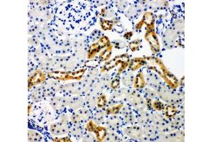 IHC-P: NOX4 antibody testing of rat kidney tissue (NADPH Oxidase 4 Antikörper  (C-Term))