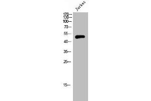 Western Blot analysis of JK cells using Septin 6 Polyclonal Antibody (Septin 6 Antikörper  (Internal Region))