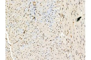 ABIN6257593 and ABIN6274990 at 1/100 staining Mouse heart tissue by IHC-P. (CEP57 Antikörper  (Internal Region))