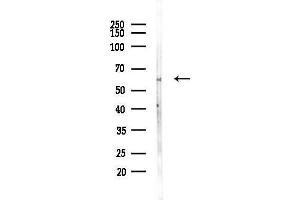 anti-Pyruvate Dehyrogenase Phosphatase Catalytic Subunit 2 (PDP2) (N-Term) antibody