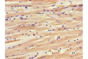 IHC image of ABIN7143542 diluted at 1:1200 and staining in paraffin-embedded human heart tissue performed on a Leica BondTM system. (SLC25A6 Antikörper  (AA 144-175))