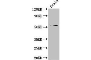 Western Blot Positive WB detected in: Mouse brain tissue All lanes: TRIM43 antibody at 3 μg/mL Secondary Goat polyclonal to rabbit IgG at 1/50000 dilution Predicted band size: 53 kDa Observed band size: 53 kDa (TRIM43 Antikörper  (AA 43-240))