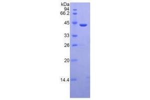 MBL2 Protein (AA 130-248) (His tag,GST tag)