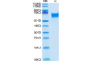 IL18R1 Protein (AA 19-329) (His-Avi Tag,Biotin)