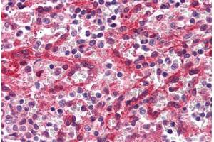 Human Spleen, Red Pulp (formalin-fixed, paraffin-embedded) stained with DARC antibody ABIN337034 at 2. (DARC Antikörper  (C-Term))