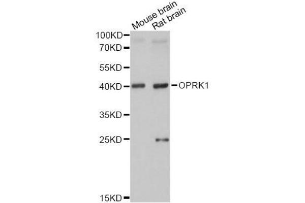OPRK1 antibody  (C-Term)