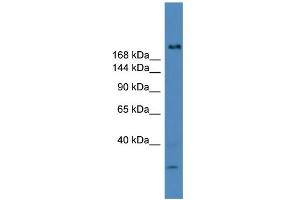 WB Suggested Anti-USP9Y Antibody Titration: 0. (USP9Y Antikörper  (C-Term))