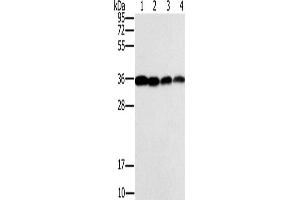 Western Blotting (WB) image for anti-Centromere Protein V (CENPV) antibody (ABIN2433633) (CENPV Antikörper)