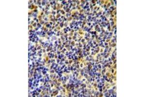 Immunohistochemistry analysis in formalin fixed and paraffin embedded human tonsil tissue using IKZF1/IKAROS Antibody (C-term), followed by peroxidase conjugation of the secondary antibody and DAB staining. (IKZF1 Antikörper  (C-Term))